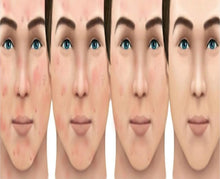 Load image into Gallery viewer, CLear Skin Formula